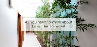 laser hair removal