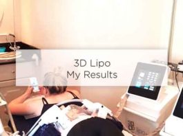 3d lipo results before after