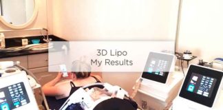 3d lipo results before after