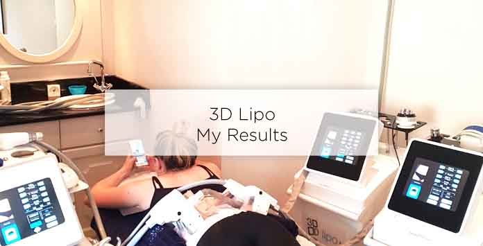 3d lipo results before after